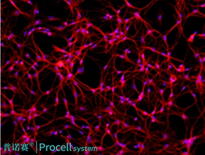 免疫荧光鉴定图片(β-Tubulin)