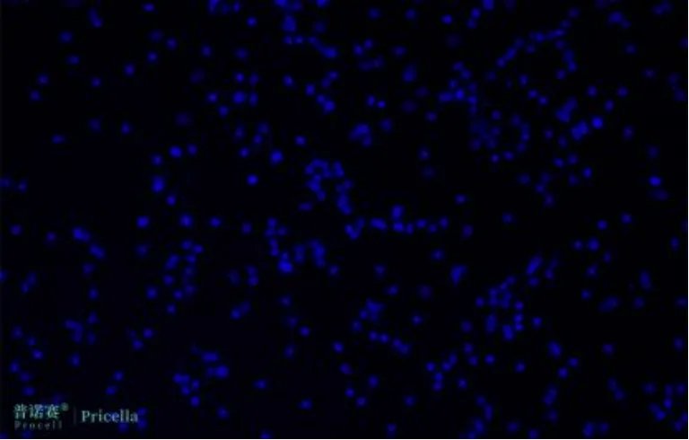 大鼠神經(jīng)星形膠質(zhì)細(xì)胞免疫熒光鑒定DAPI