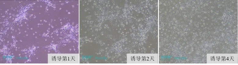 神經(jīng)干細(xì)胞誘導(dǎo)分化為星形膠質(zhì)細(xì)胞的形態(tài)變化