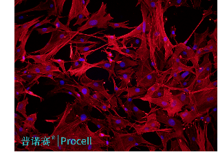 小鼠腦微血管周細(xì)胞  （α-SMA）免疫熒光鑒定