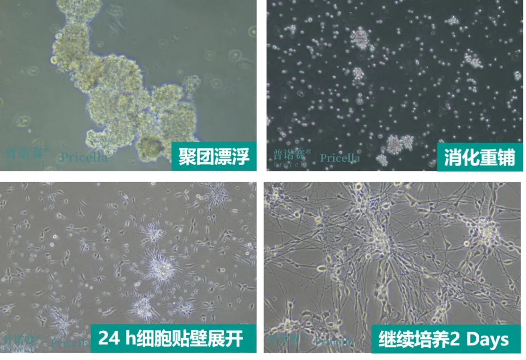 大鼠背根神經(jīng)元細(xì)胞常溫運(yùn)輸后的聚團(tuán)處理