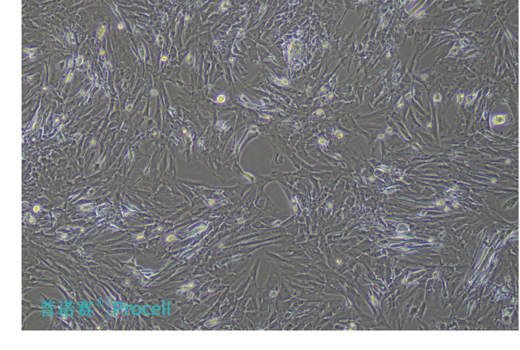 大鼠大隱靜脈平滑肌細(xì)（α-SMA）72小時(shí)的形態(tài)觀察圖